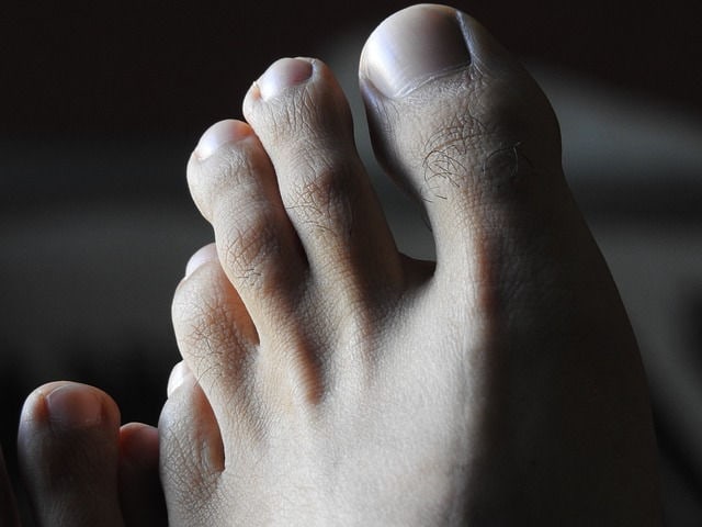 image of toes